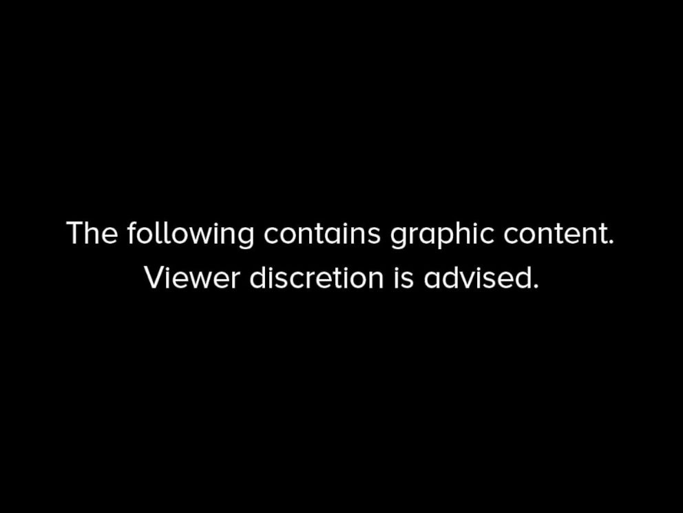 PHOTO: Graphic content warning.