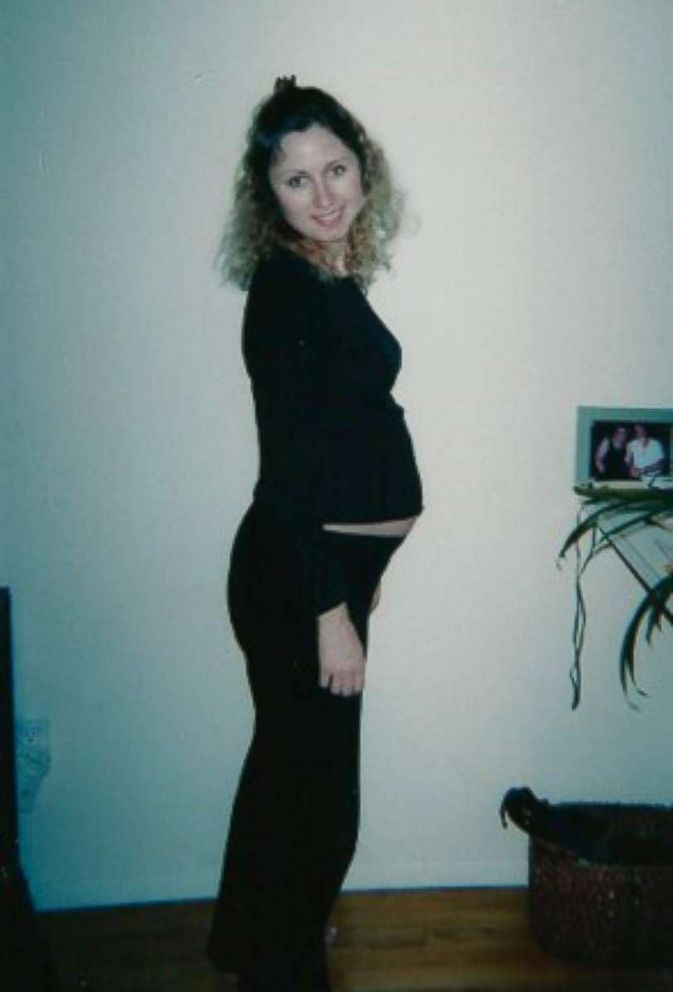 PHOTO: Magda Newman is pictured here pregnant with her first child Nathaniel, who was born with Treacher Collins syndrome.