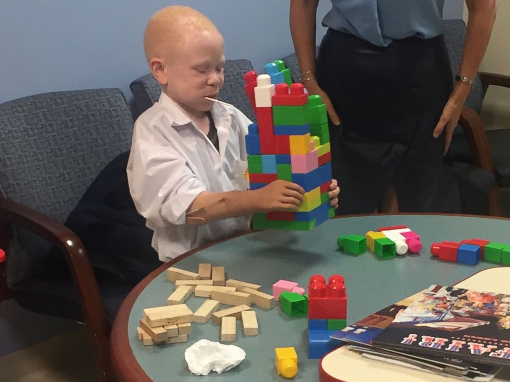 PHOTO: Baraka, a child from Tanzania whose arm was cut off because he has albinism, plays using his new prosthetic arm at Shriners Hospital for Children.