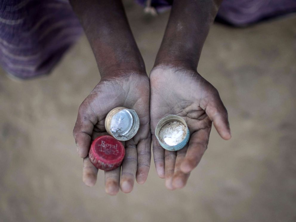 PHOTO: Rohingya migrant boy Abdul Hafez (5), who arrived in Bangladesh in September, holds bottle tops that he uses to play a game called Medakhela at the Thankhali refugee camp in Coxs Bazar, Dec. 2, 2017. 