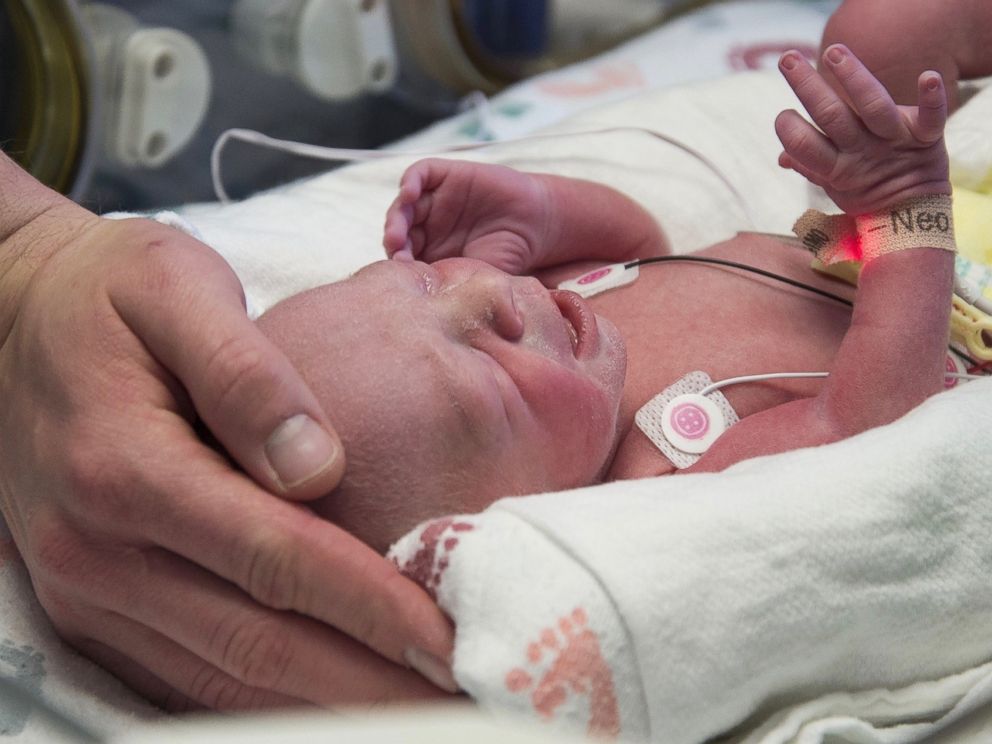 PHOTO: The first American baby born from a transplanted uterus is photographed after being born at the Baylor University Medical Center in Dallas, Texas. 