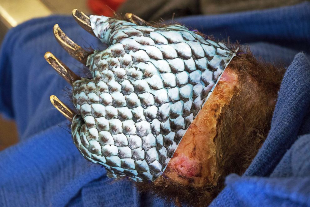 PHOTO: The badly burned paw of a bear, injured in a wildfire, is wrapped in fish skin during treatment at the University of California, Davis Veterinary Medical Teaching Hospital in Davis, Calif., in January 2018. 
