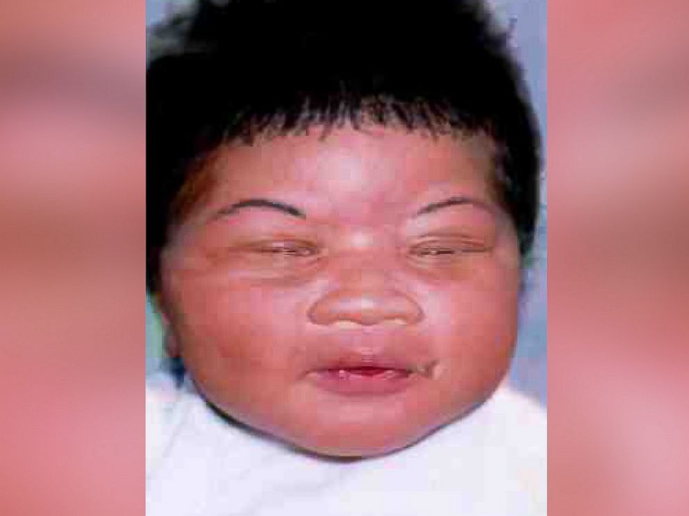 PHOTO: The Jacksonville Sheriffs Office in Florida announced on Jan. 13, 2017, that an 18-year-old woman living in Walterboro, S.C., was identified by authorities as a baby who was kidnapped from a Jacksonville hospital hours after she was born in 1998.