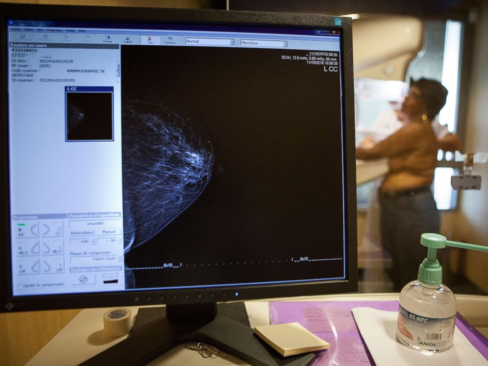 PHOTO: PHOTO: A technician carries out a routine mammogram in France, Nov. 29, 2016.
