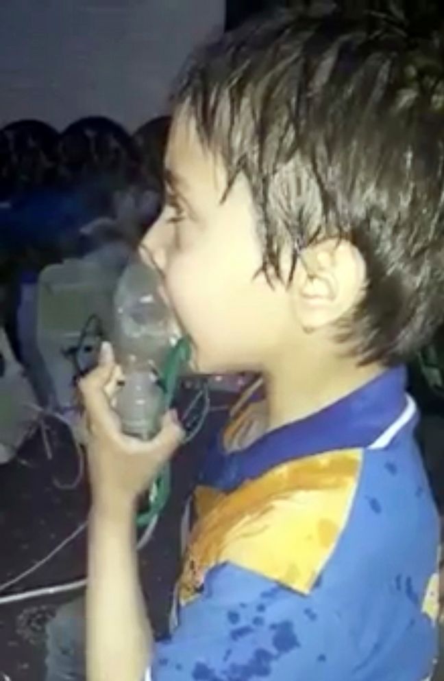 PHOTO: This image made from video released by the Syrian Civil Defense White Helmets, which has been authenticated based on its contents and other AP reporting, shows a toddler given oxygen through respirators, in eastern Ghouta, Syria, April 8, 2018.